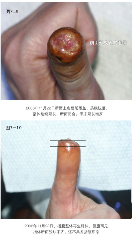 201121815824239